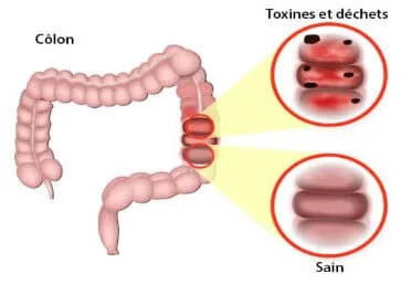 Illustration du confort digestif